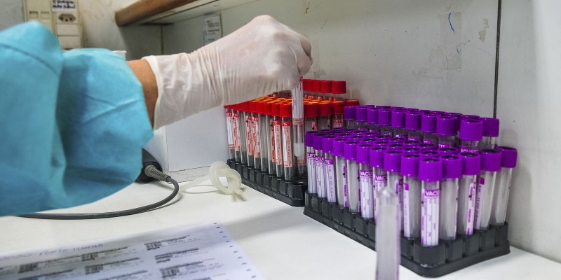 © Acácio Pinheiro/Agência Brasília