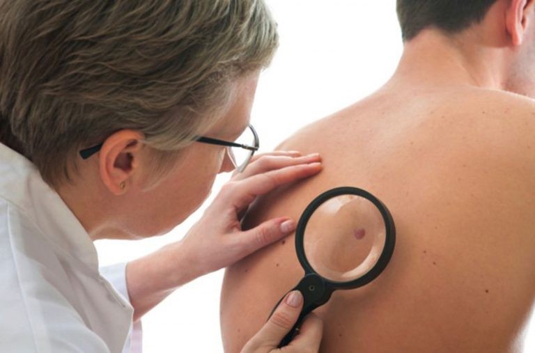 Dermatologista avalia risco de câncer de pele em paciente - (Foto: UEL/Agência de Notícias do Paraná)
